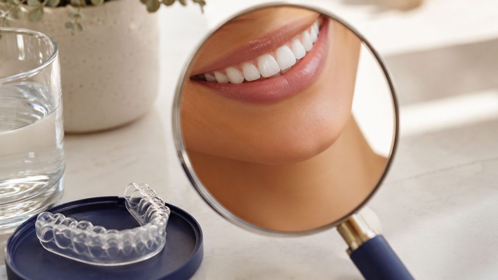 Teeth Whitening: In-Office vs. At-Home vs. Over-the-Counter (Which Is Actually Worth It?)