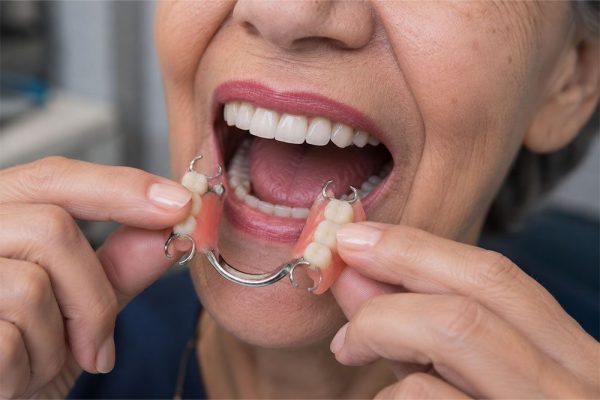 Dentures-&-partials