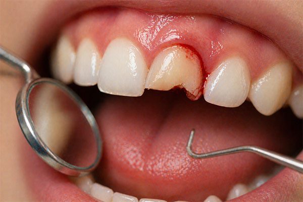 Emergency-Dental-Care.