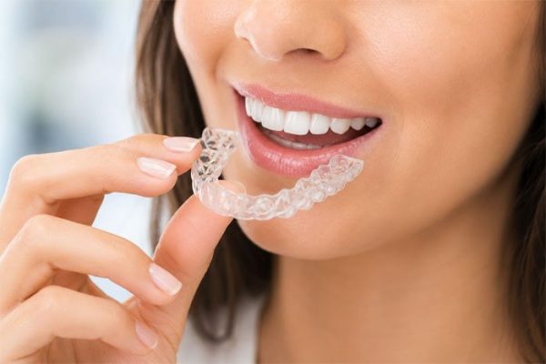 Invisalign-Full-Treatment