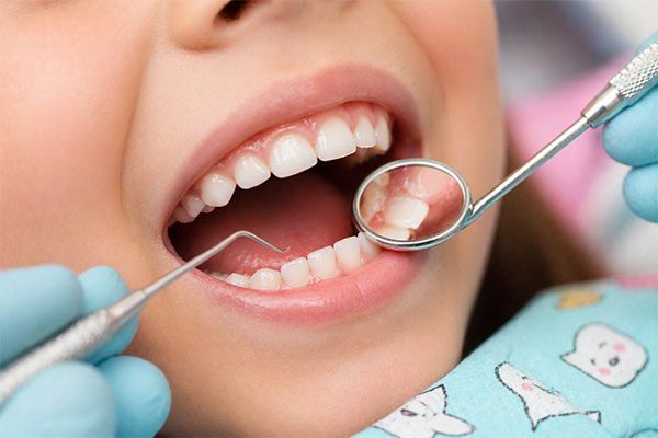 Pediatric-Dentistry.