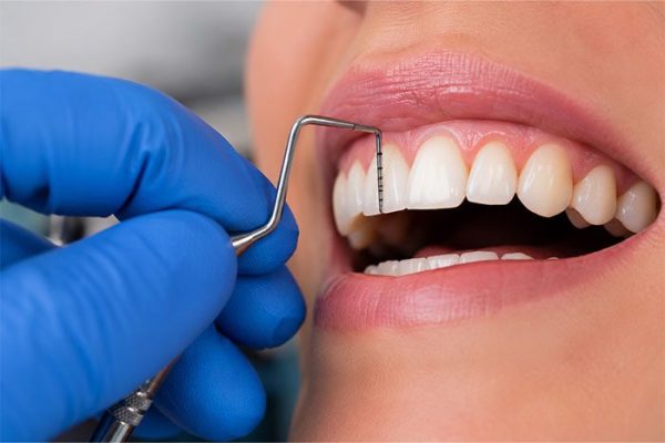 Periodontal evaluation