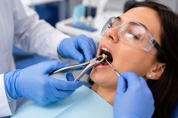 Simple-tooth-extractions
