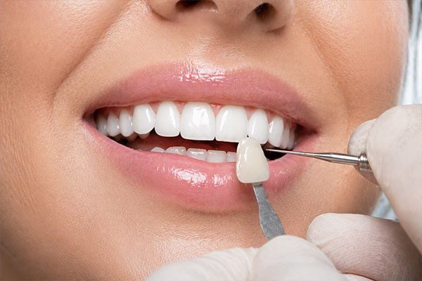 cosmetic-dentistry